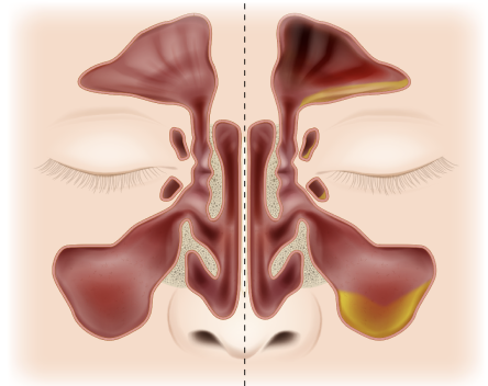 sinuses